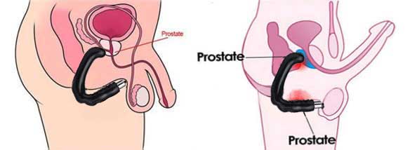 เครื่องนวดต่อมลูกหมาก รุ่น 2 นวดกระตุ้นจุด P-SPOT สำหรับท่านชาย ช่วยให้อวัยวะเพศชายแข็งตัวดีขึ้น ใช้เพิ่มความสุข สนุกขณะร่วม ทำความสะอาดง่าย ปลอดภัย